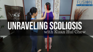 <    Unraveling Scoliosis