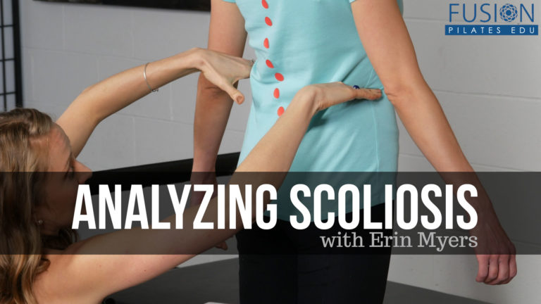 Analyzing Scoliosis