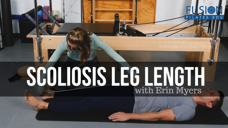 Scoliosis Leg Length