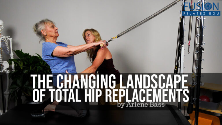 The Changing Landscape of Total Hip Replacements